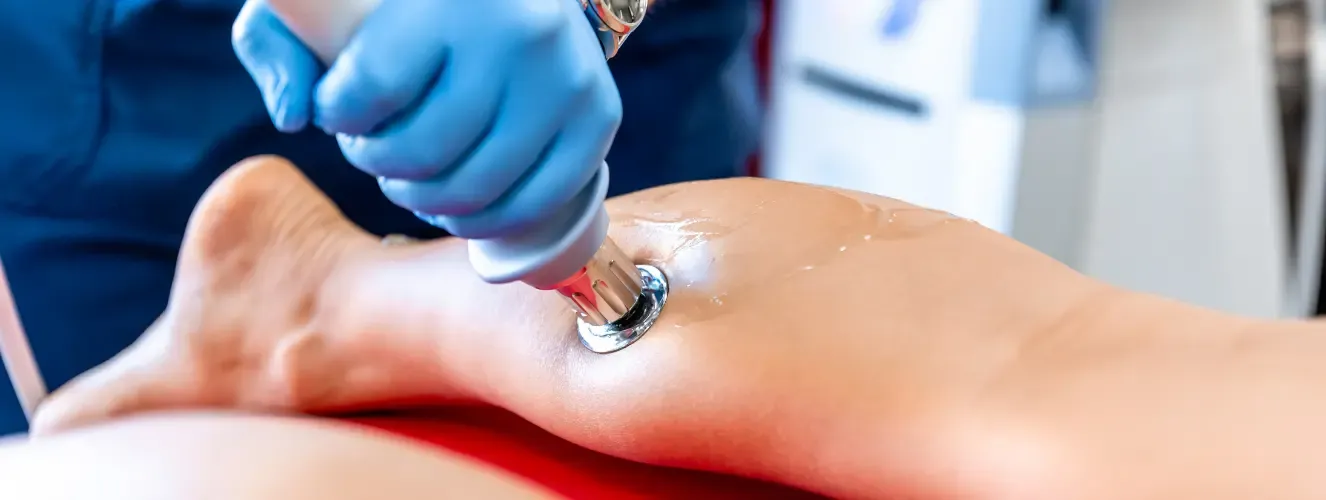 Shockwave Therapy in Mission